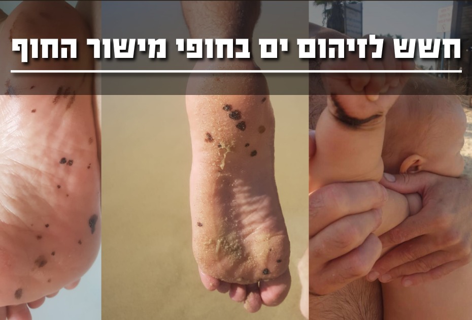 זיהום מי ים במישור החוף