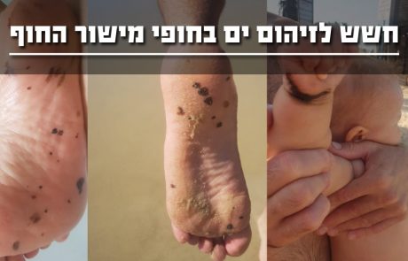 חשש לזיהום מי ים בחופי מישור החוף